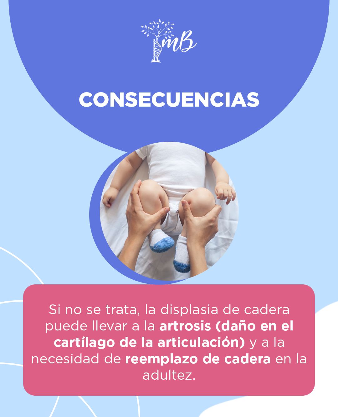 slider-tamiz-de-cadera-informacion 4